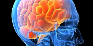 Νέο σύστημα τεχνητής νοημοσύνης εντοπίζει μικρές εγκεφαλικές αιμορραγίες καλύτερα και από τους ακτινολόγους