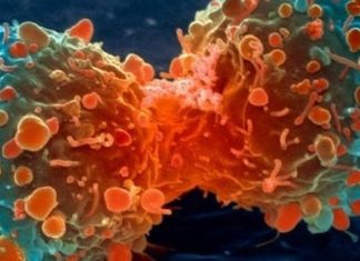 Ιατρικό επίτευγμα: Μετέτρεψαν καρκινικά κύτταρα σε λίπος