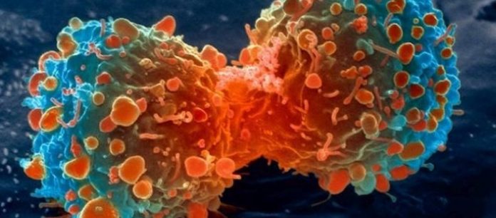Ιατρικό επίτευγμα: Μετέτρεψαν καρκινικά κύτταρα σε λίπος